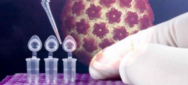 Diagnóstico de HPV usando o teste digene