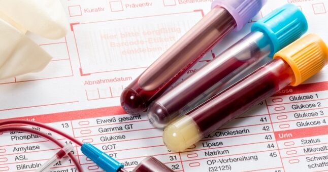 Exame de sangue para papilomavírus humano